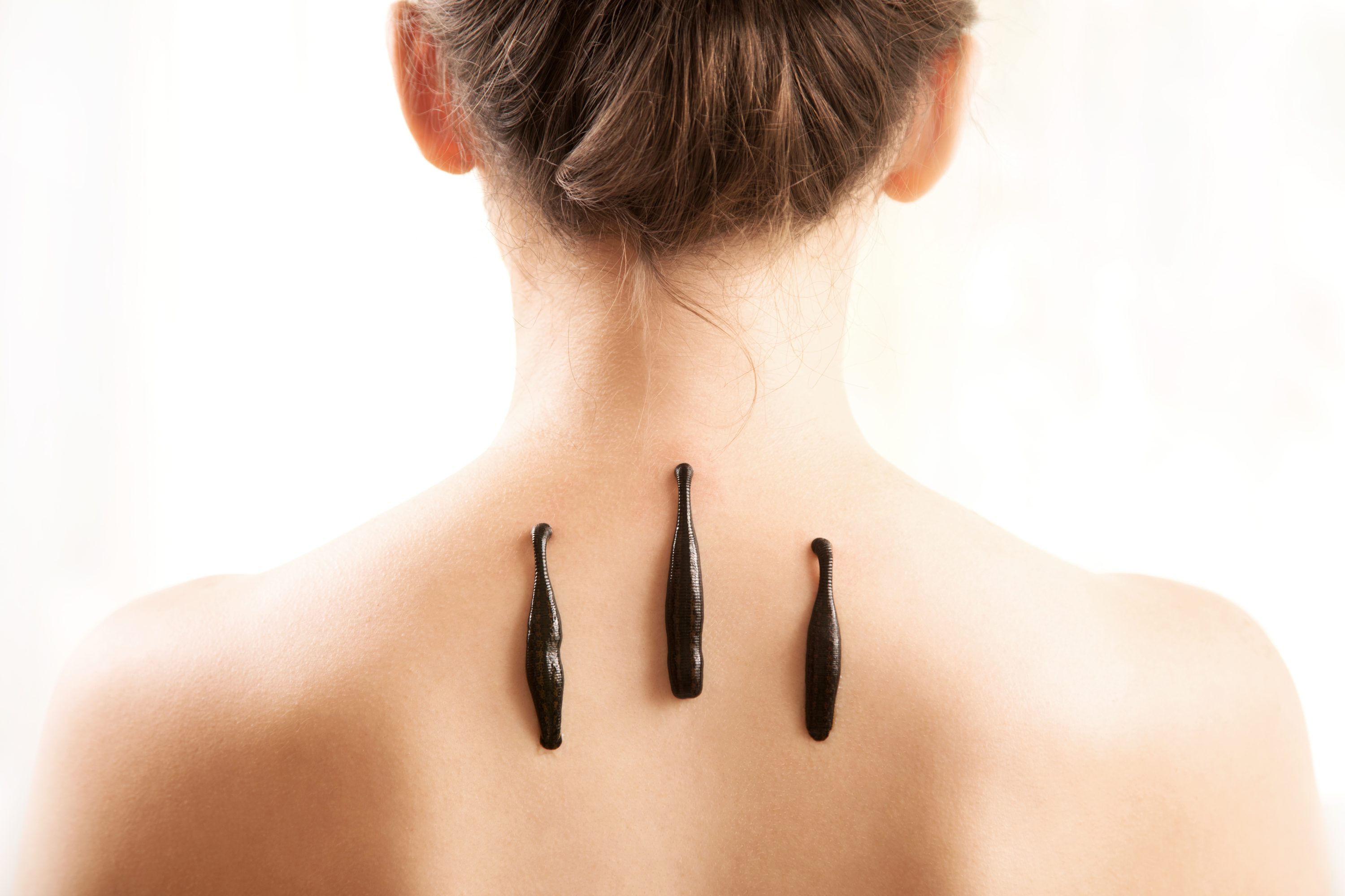 Health Conditions & Ayurvedic Medicine in Nyon